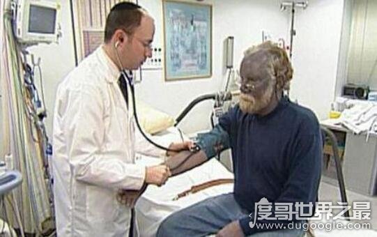 世界上真实存在的蓝种人,浑身皮肤呈蓝色